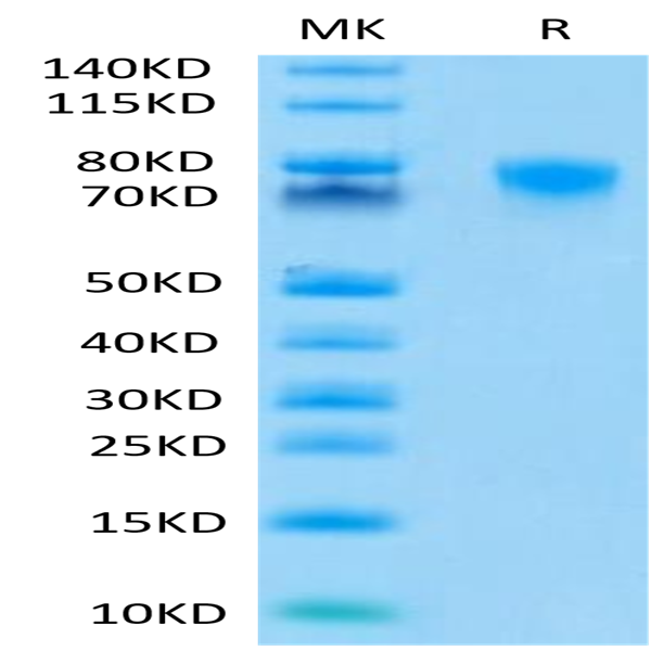 Human TNFR2/CD120b/TNFRSF1B Protein (TNF-HM3R2)