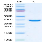 Human TPM1 Protein (TPM-HE101)