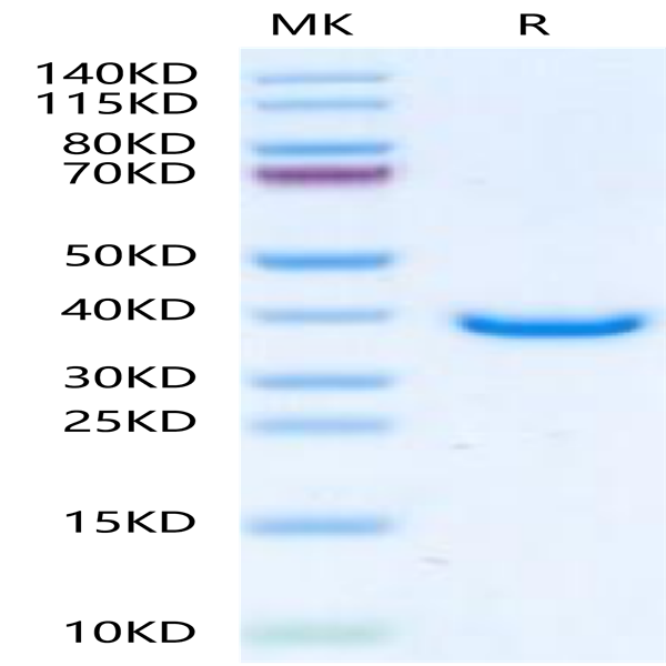 Human TPM1 Protein (TPM-HE101)