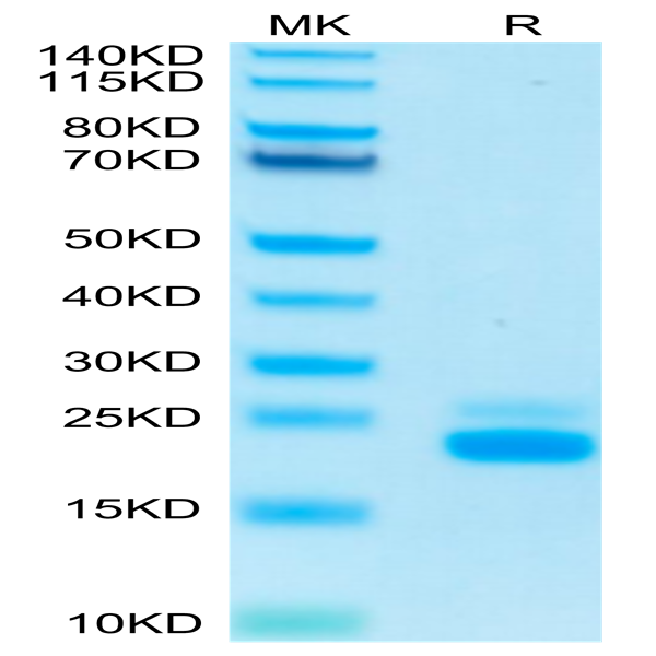 Human TRAIL R2/DR5/TNFRSF10B Protein (TRL-HM4R2)