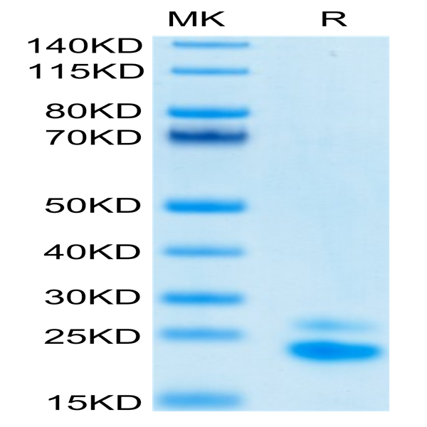 Biotinylated Human TRAIL R2/DR5/TNFRSF10B Protein (TRL-HM4R2B)