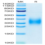 Human TREM2 Protein (TRM-HM102)