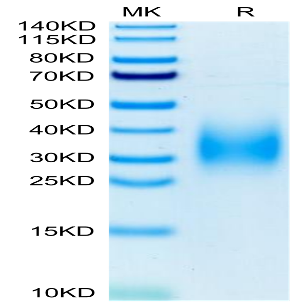Human TREM2 Protein (TRM-HM102)