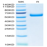 Human TREM2 Protein (TRM-HM201)
