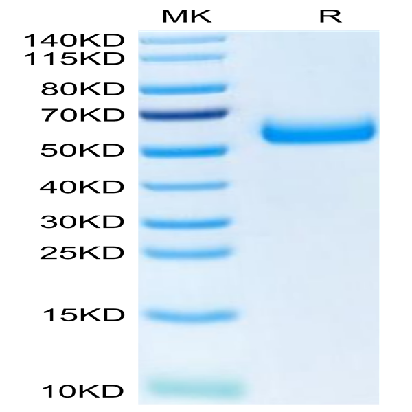 Human TREM2 Protein (TRM-HM201)