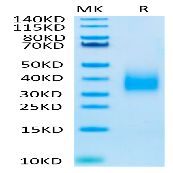 Biotinylated Human TREM2 Protein (TRM-HM401B)