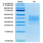 Mouse TREM2 Protein BP004348 Syd Labs