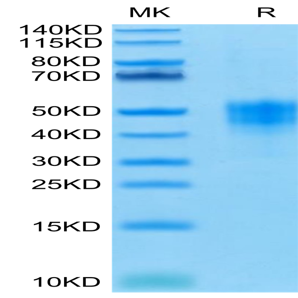 Human TROP-2/TACSTD2 Protein (TRP-HM121)