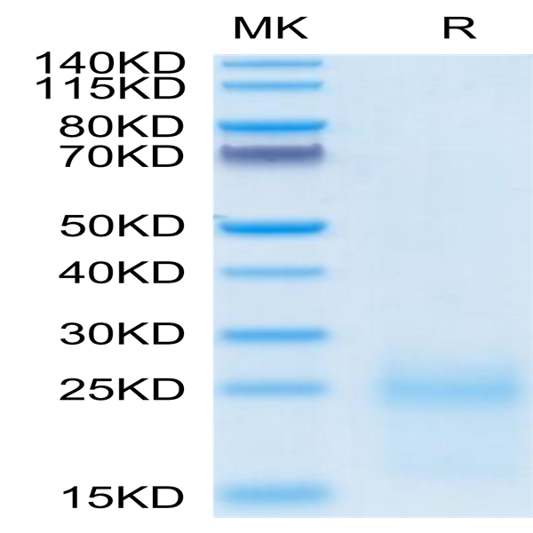 Biotinylated Cynomolgus TSLP Protein (Primary Amine Labeling) (TSP-CM101B)