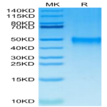 Cynomolgus TSLPR Protein (TSP-CM10R)Cynomolgus TSLPR Protein (TSP-CM10R)