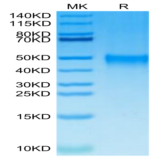Cynomolgus TSLPR Protein (TSP-CM10R)