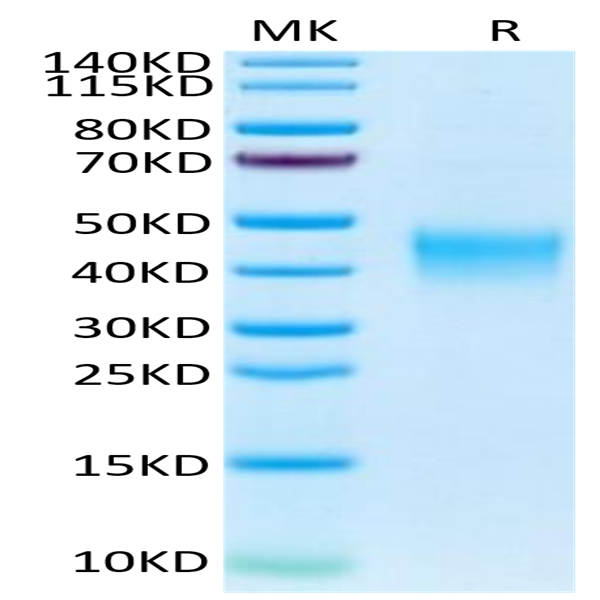 Human TSLPR Protein (TSP-HM10R)