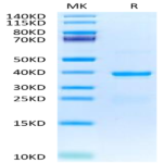 Human TSLP Protein (TSP-HM201)