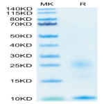 Human TSLP Protein (TSP-HM401)