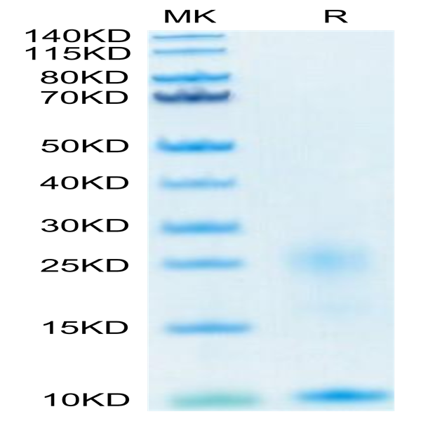 Human TSLP Protein (TSP-HM401)