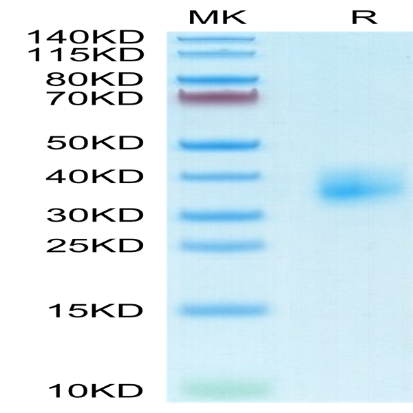 Mouse TSLPR Protein (TSP-MM10R)