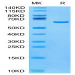 Human Tulp1 Protein BP003608 Syd Labs