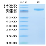 Human VCAM-1/CD106 Protein (VAM-HM106)
