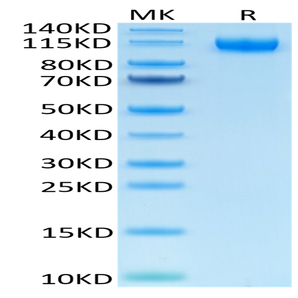 Human VEGF R1/FLT-1 Protein (VGF-HM4R1)