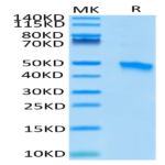 Human VSIG4 Protein (VSG-HM104)