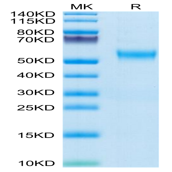 Human VSTM5 Protein (VSM-HM205)