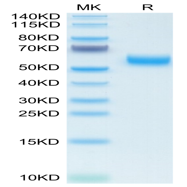 Mouse VSTM5 Protein (VSM-MM205)